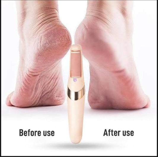 Professional Rechargeable Electric Foot Grinder – Instant Callus Remover & Dead Skin Scrubber